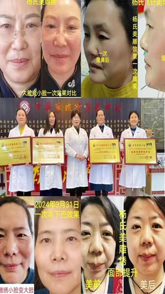 優(yōu) 秀學(xué)員事例（濰坊奎文區(qū)陳愛(ài)菊）